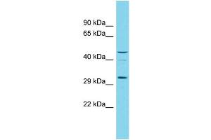 Host:  Rabbit  Target Name:  RGD1305007  Sample Type:  Rat Testis lysates  Antibody Dilution:  1. (OGFOD3 抗体  (N-Term))
