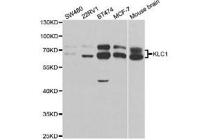 Western blot analysis of extracts of various cell lines, using KLC1 antibody. (KLC1 抗体  (AA 261-560))