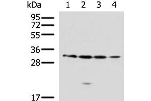 Western blot analysis of 293T A549 Jurkat 231 cell lysates using RCHY1 Polyclonal Antibody at dilution of 1:650 (RCHY1 抗体)