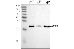 Western blot analysis of APRT using anti-APRT antibody (ABIN4886471). (APRT 抗体  (N-Term))