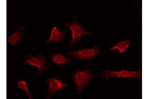 ABIN6269296 staining NIH-3T3 by IF/ICC. (14-3-3 zeta 抗体  (C-Term))