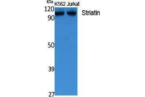 Western Blotting (WB) image for anti-Striatin (STRN) (C-Term) antibody (ABIN3178123) (Striatin 抗体  (C-Term))