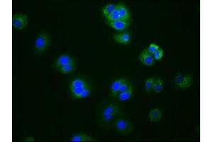 Immunofluorescence staining of HepG2 cells with ABIN7127445 at 1:76, counter-stained with DAPI. (Recombinant Aromatase 抗体)