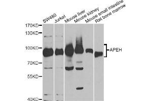 Western blot analysis of extracts of various cell lines, using APEH antibody. (APEH 抗体)