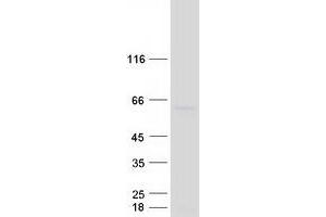 Centrosomal Protein 55kDa (CEP55) (Transcript Variant 1) protein (Myc-DYKDDDDK Tag)