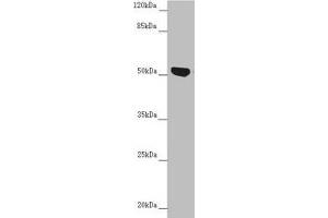 Western blot All lanes: NUF2 antibody at 5. (NUF2 抗体  (AA 165-464))