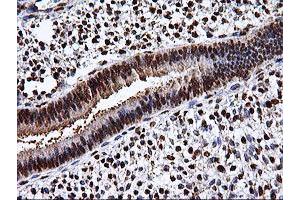 Image no. 9 for anti-EPM2A (Laforin) Interacting Protein 1 (EPM2AIP1) antibody (ABIN1498046) (EPM2AIP1 抗体)