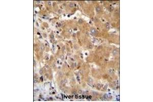 GGH Antibody (N-term) (ABIN655183 and ABIN2844798) immunohistochemistry analysis in formalin fixed and paraffin embedded human liver tissue followed by peroxidase conjugation of the secondary antibody and DAB staining. (GGH 抗体  (N-Term))