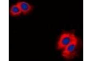Immunofluorescent analysis of CARD11 staining in K562 cells. (CARD11 抗体  (N-Term))