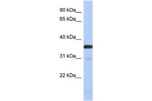 WB Suggested Anti-ESD Antibody Titration: 0. (Esterase D 抗体  (N-Term))