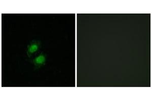 Immunofluorescence analysis of A549 cells, using ZNF95 antibody. (ZNF95 抗体  (Internal Region))