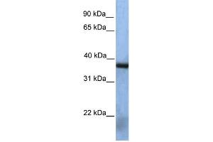WB Suggested Anti-NAT12 Antibody Titration:  0.