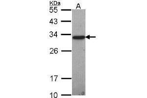 WB Image Sample (30 ug of whole cell lysate) A: Hep G2 , 12% SDS PAGE antibody diluted at 1:1000 (GSTO1 抗体)