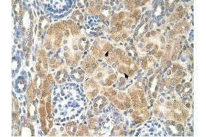 Immunohistochemistry (IHC) image for anti-Nuclear Receptor Subfamily 2, Group F, Member 2 (NR2F2) (N-Term) antibody (ABIN925921)