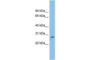 WB Suggested Anti-C1orf104 Antibody Titration: 0. (C1orf104 抗体  (Middle Region))