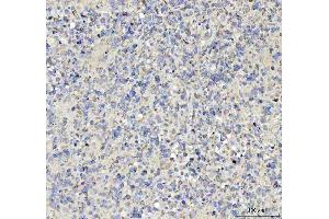 IHC analysis of TNR using anti-TNR antibody (ABIN4886752). (Tenascin R 抗体  (C-Term))