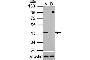 WB Image Western blot analysis of TDP-43 (, upper panel) and beta-actin , lower panel)  Sample (30 ug of whole cell lysate)   A: HeLa mock control  B: HeLa transfected shTDP-43 10% SDS PAGE  antibody diluted at 1:500 (TARDBP 抗体)