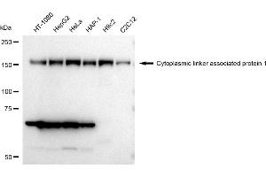 Western blotting analysis using Cytoplasmic linker associated protein 1 antibody (ABIN7798265).