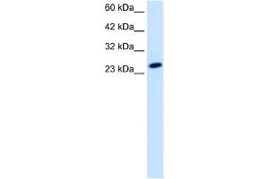 WB Suggested Anti-TBPL1 Antibody Titration:  1. (TBPL1 抗体  (Middle Region))