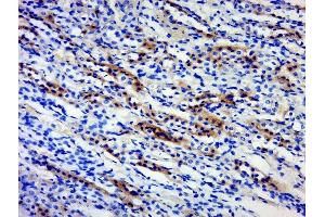 Paraformaldehyde-fixed, paraffin embedded rat kidney, Antigen retrieval by boiling in sodium citrate buffer (pH6) for 15min, Block endogenous peroxidase by 3% hydrogen peroxide for 30 minutes, Blocking buffer (normal goat serum) at 37°C for 20min, Antibody incubation with 	BPTF/FALZ Polyclonal Antibody, Unconjugated  at 1:500 overnight at 4°C, followed by a conjugated secondary and DAB staining. (BPTF 抗体  (AA 2801-3046))