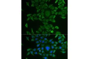 Immunofluorescence analysis of U2OS cells using CCBL1 Polyclonal Antibody (CCBL1 抗体)