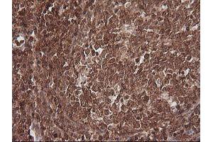 Image no. 6 for anti-Melanoma Antigen Family A, 4 (MAGEA4) antibody (ABIN1499260) (MAGEA4 抗体)