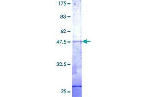 RER1 Protein (AA 1-196) (GST tag)