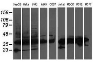 Image no. 3 for anti-ATG3 Autophagy Related 3 (ATG3) antibody (ABIN1496762) (ATG3 抗体)