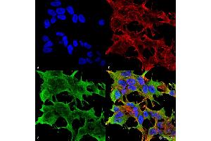 Immunocytochemistry/Immunofluorescence analysis using Mouse Anti-GluA1/GluR1 Glutamate Receptor Monoclonal Antibody, Clone S355-1 . (Glutamate Receptor 1 抗体  (AA 1-389) (FITC))