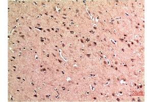 Immunohistochemical analysis of paraffin-embedded Human Brain Tissue using Beclin-1 Mouse mAb diluted at 1:200. (Beclin 1 抗体)
