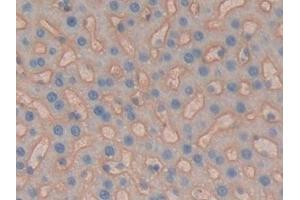 Immunohistochemistry (IHC) image for anti-Basigin (Ok Blood Group) (BSG) (AA 59-321) antibody (ABIN7440611)