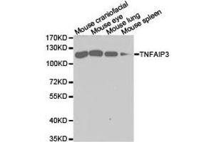 Western Blotting (WB) image for anti-Tumor Necrosis Factor, alpha-Induced Protein 3 (TNFAIP3) antibody (ABIN1875125) (TNFAIP3 抗体)