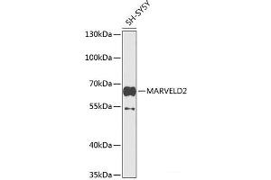 Western blot analysis of extracts of SH-SY5Y cells using MARVELD2 Polyclonal Antibody at dilution of 1:1000. (Tricellulin 抗体)