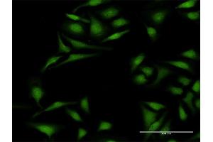 Immunofluorescence of purified MaxPab antibody to KRT12 on HeLa cell. (KRT12 抗体  (AA 1-494))