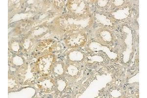 ABIN6264687 and ABIN6273308 at 1/100 staining human normal kidney tissue by IHC-P.