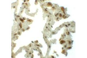 Immunohistochemistry (IHC) image for anti-Transmembrane 4 L Six Family Member 1 (TM4SF1) (N-Term) antibody (ABIN1031625) (TM4SF1 抗体  (N-Term))