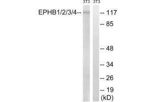 Western blot analysis of extracts from 3T3 cells, treated with heat shock, using EPHB1/2/3/4 (Ab-600/602/614/596) antibody. (Ephb1+Ephb2+Ephb3+Ephb4 (Tyr596), (Tyr600), (Tyr602), (Tyr614) 抗体)