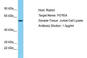 Host: Rabbit Target Name: POTEA Sample Tissue: Human Jurkat Whole Cell Antibody Dilution: 1ug/ml (POTEA 抗体  (C-Term))