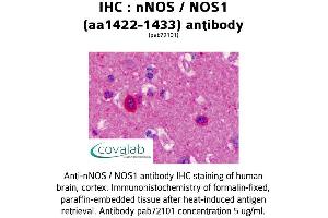 Image no. 1 for anti-Nitric Oxide Synthase 1, Neuronal (NOS1) (AA 1422-1433) antibody (ABIN5693644) (NOS1 抗体  (AA 1422-1433))