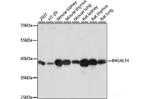 Western blot analysis of extracts of various cell lines using B4GALT4 Polyclonal Antibody at dilution of 1:1000. (B4GALT4 抗体)