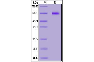 Mouse NOTCH1, His Tag on  under reducing (R) condition. (Notch1 Protein (AA 19-526) (His tag))