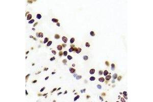 Immunohistochemistry (IHC) image for anti-Upstream Transcription Factor 1 (USF1) antibody (ABIN7308482) (USF1 抗体)