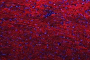 anti-Desmin (DES) (AA 1-304) antibody