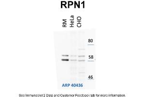 WB Suggested Anti-RPN1 Antibody Titration: 1 µg/mL Positive Control: HeLa and CHO-K1 cell lines, rouch canine microsomes (RPN1 抗体  (N-Term))