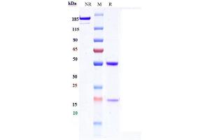 Anti-SEZ6 Reference Antibody (Abbv-011) on SDS-PAGE under reducing (R) condition.