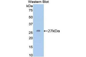 Western Blotting (WB) image for anti-Glutathione S-Transferase mu 2 (Muscle) (GSTM2) (AA 1-218) antibody (ABIN1078085) (GSTM2 抗体  (AA 1-218))