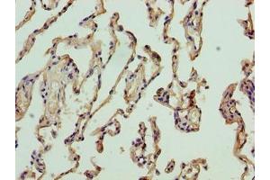 Immunohistochemistry of paraffin-embedded human lung tissue using ABIN7161563 at dilution of 1:100 (NICN1 抗体  (AA 1-213))