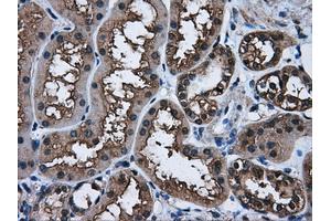 Immunohistochemical staining of paraffin-embedded Kidney tissue using anti-AKR1A1mouse monoclonal antibody. (AKR1A1 抗体)