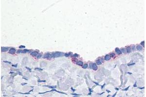 Human Ovary: Formalin-Fixed, Paraffin-Embedded (FFPE) (ENPP3 抗体  (C-Term))