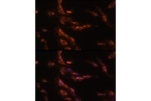Immunofluorescence (IF) image for anti-gamma-aminobutyric Acid (GABA) A Receptor, gamma 1 (GABRg1) (AA 200-260) antibody (ABIN7267344)